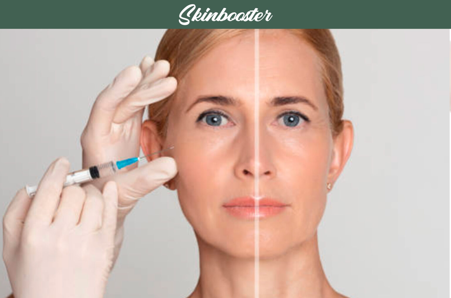 Skinbooster Injentavel - Veja Skinbooster Antes e Depois!